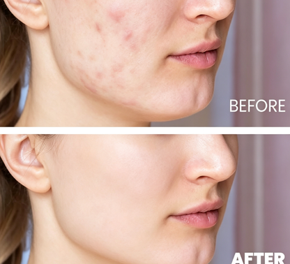 Green Tea Deep Cleanse Mask Stick – Pore Refining & Oil Control Clay Mask